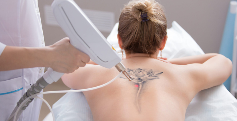 Laser For Hair, Tattoo and Scar Removal
